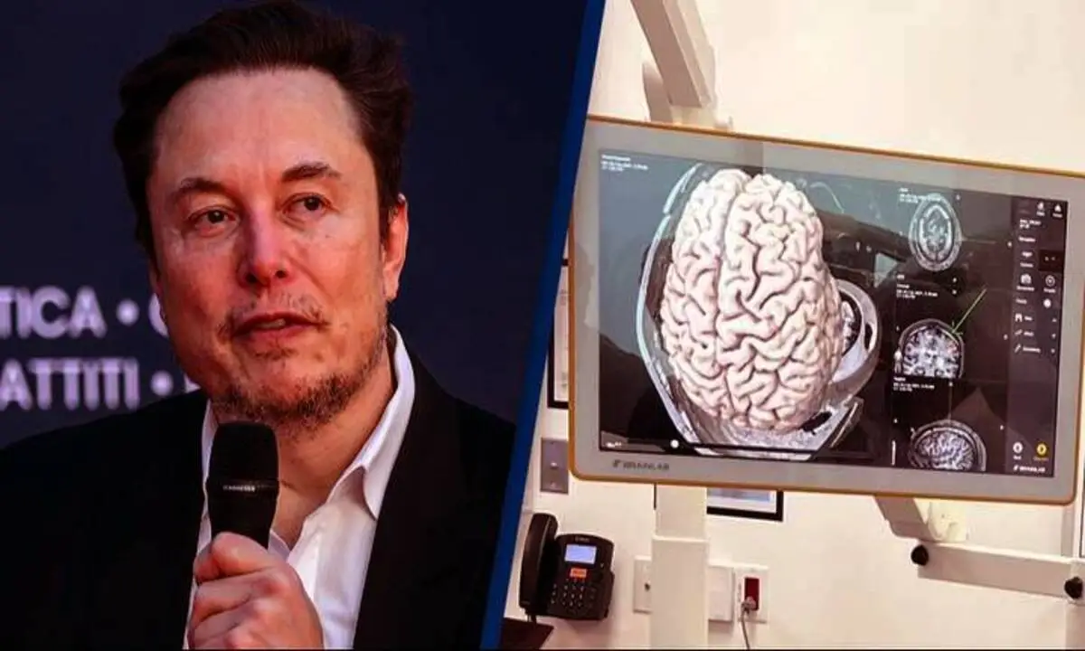 Unlocking Human Potential Elon Musk's Neuralink Implants Brain Chip in First Human